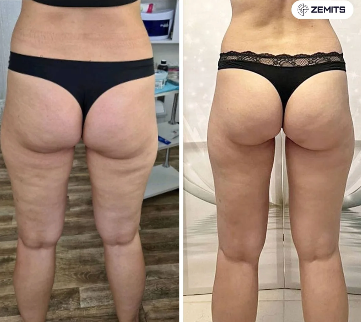 Before After